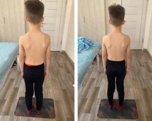 Эффект лечебного детского массажа в Одессе до и после