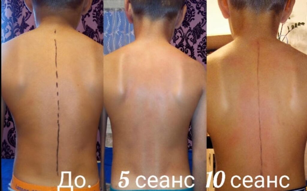Кинезиология и мануальная терапия в Одессе