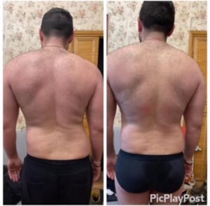 Медицинский массаж шейно-воротниковой зоны в Одессе Ocsarat Medical