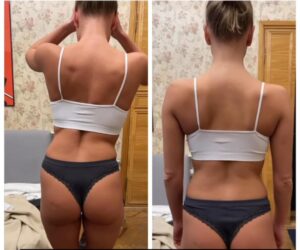 Лечебный массаж поясницы и мышечное вытяжение в клинике Ocsarat Medical